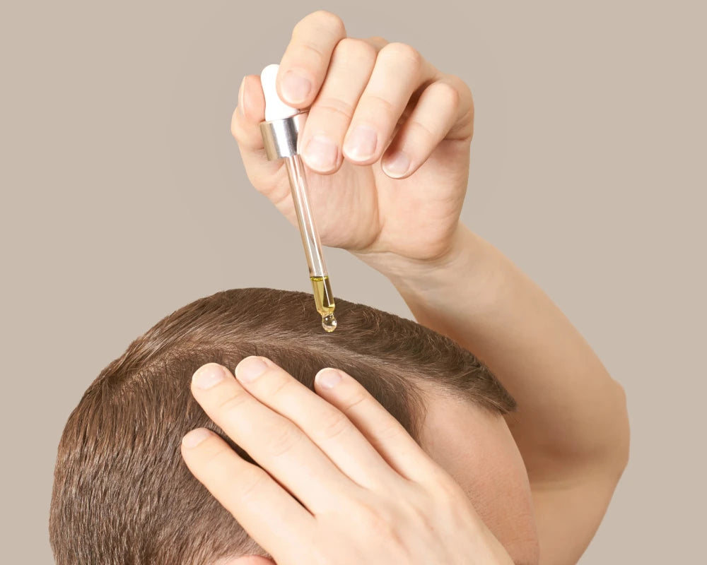Compounded medication being applied for hair loss treatment